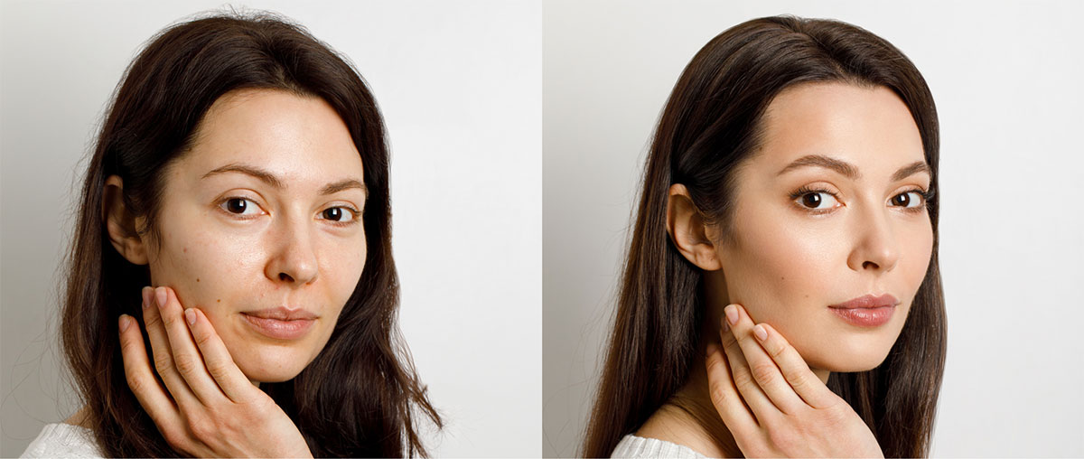 Oxygeneo Facial Before and After Results